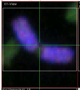 zoomed into a use defined ROI